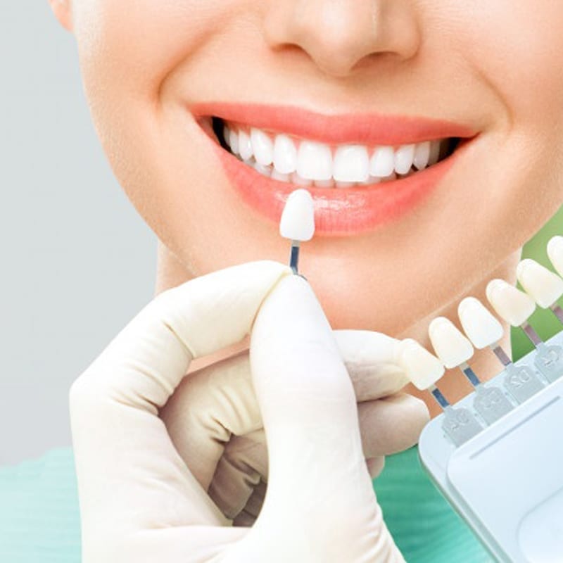 Cosmetic-Dentistry