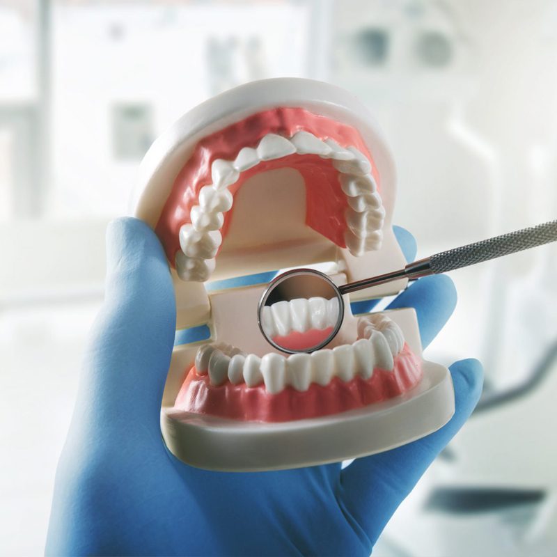 teeth-restoration
